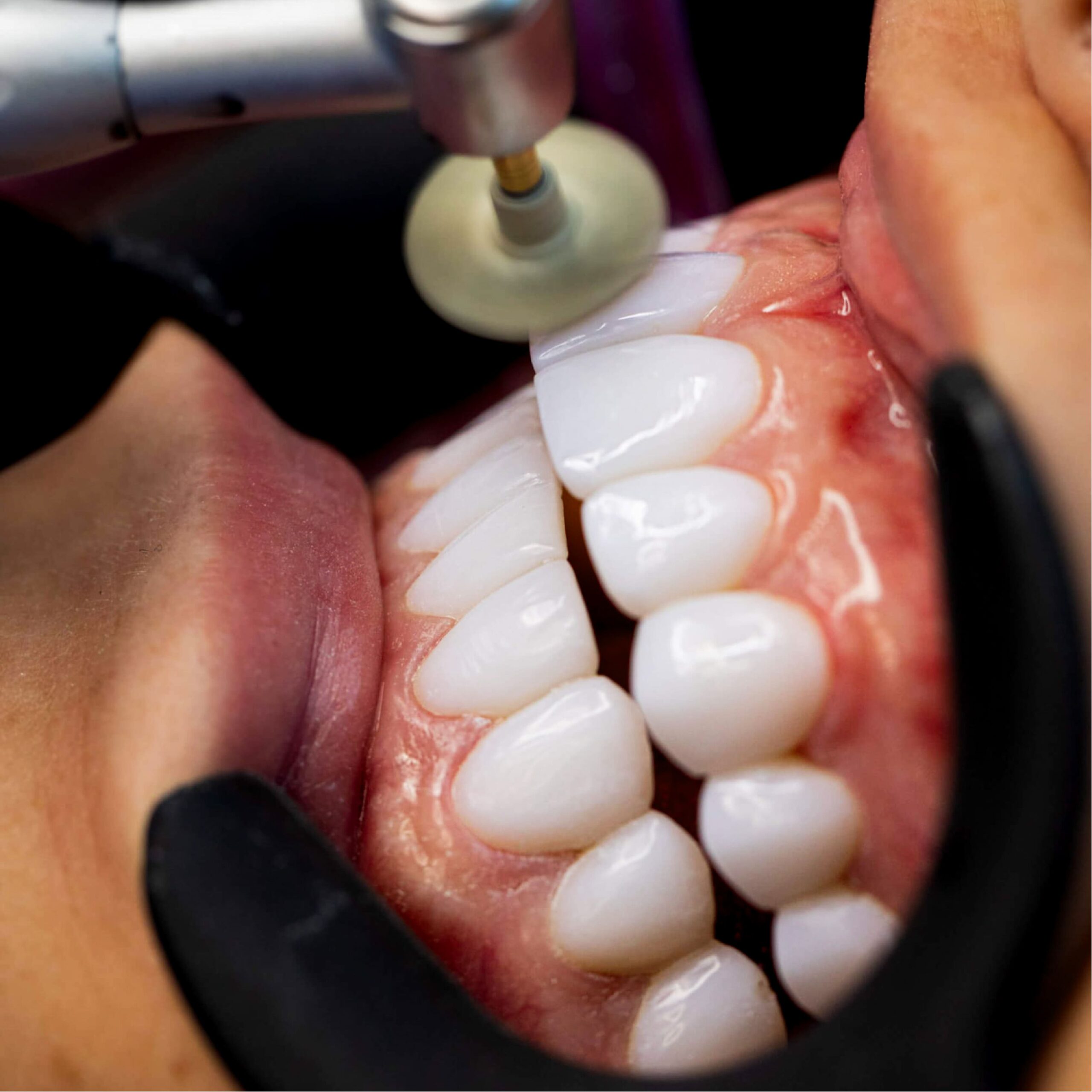 galeria_Mesa de trabajo 1